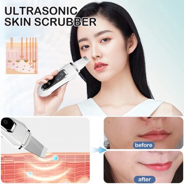 Ультразвуковой скрабер для лица Ultrasonic Facial Beauty Device