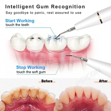 Скалер зубной PEICON N-G6 ультразвуковой для удаления каменя и пятен