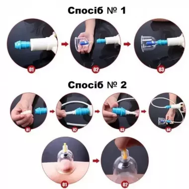 Масажні антицелюлітні вакуумні банки 32 шт JINKANG із вакуумним насосом