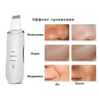 Аппарат для ультразвуковой чистки лица Ultrasonic Shovel