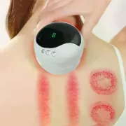 Антицелюлітний вакуумний масажер Intelligent Cupping Massage, акумуляторний ручний масажер для тіла Білий LY-873-White
