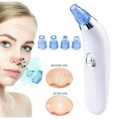 Вакуумный очиститель Derma suction DS Vacuum для профессиональной чистки кожи и пор лица - легкий компактный удобный прибор в использовании + 4 насадки, Белый