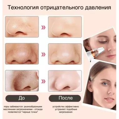 Вакуумный очиститель кожи и пор Multi-Functional для чистки лица